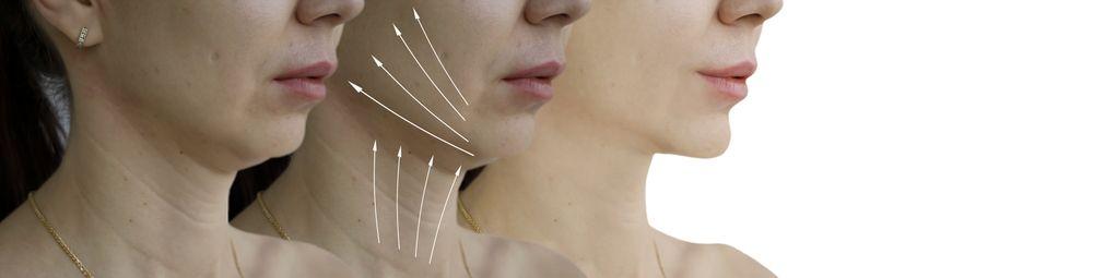 7_surprising_facts_about_botox_you_didnt_know